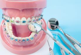 Ordem lança campanha de alerta para perigo de compra de aparelhos dentários na net