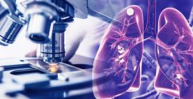 Sociedade Portuguesa de Pneumologia alerta para estigma associado à tuberculose